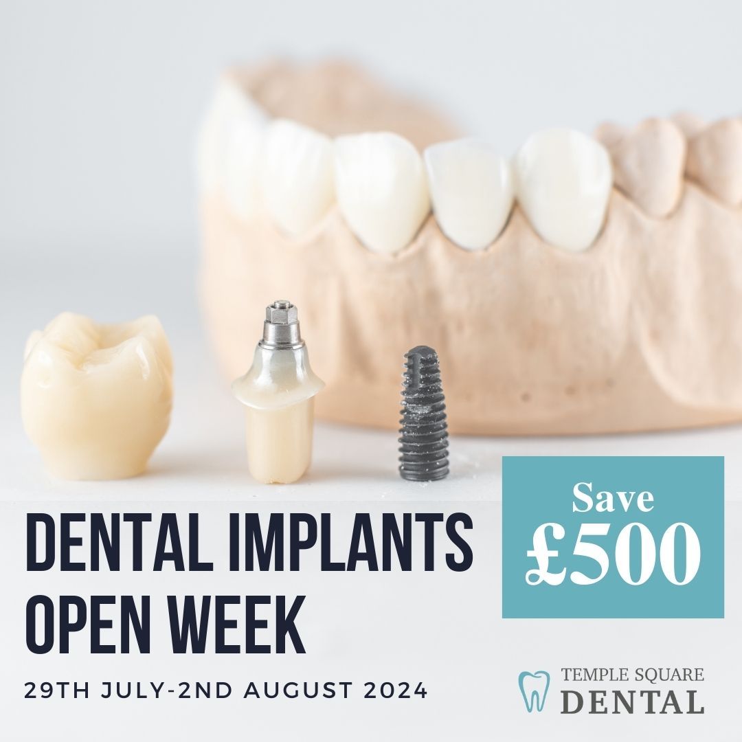 Dental Implants Open Week